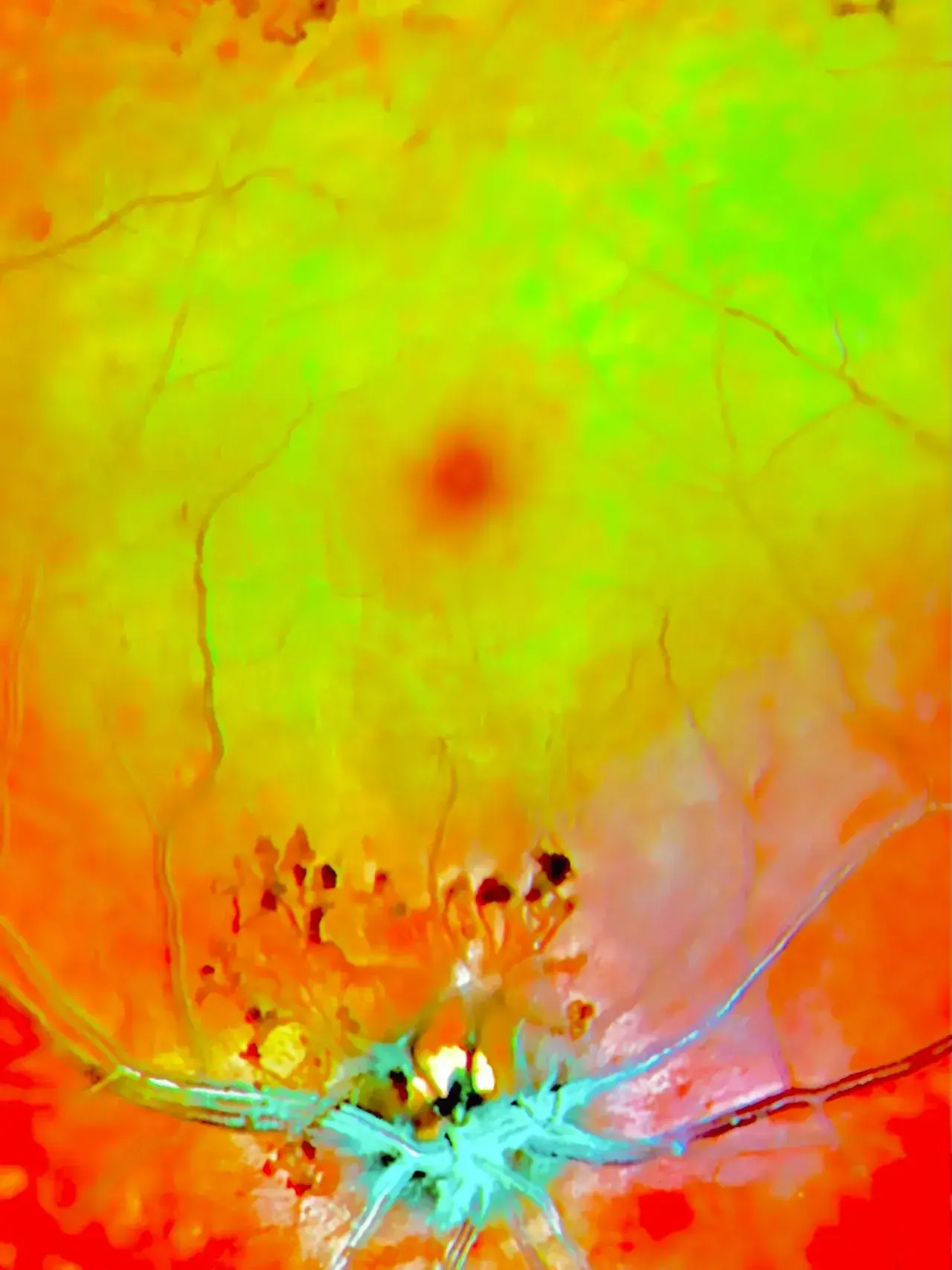 Art Meets Retina